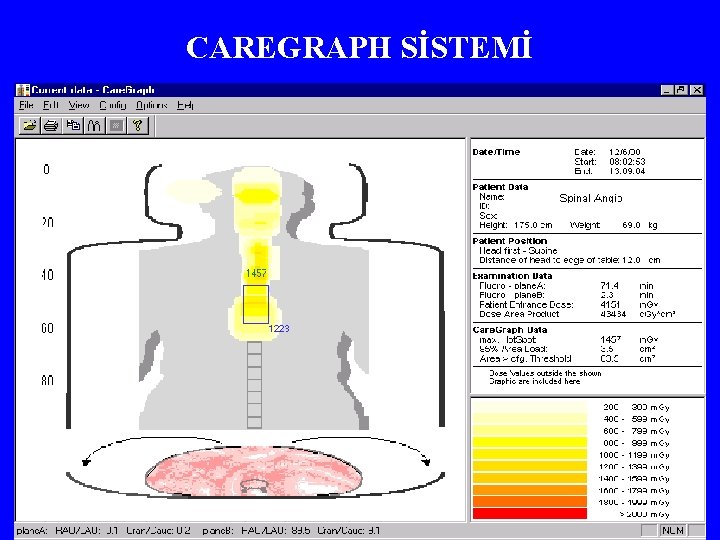 CAREGRAPH SİSTEMİ 