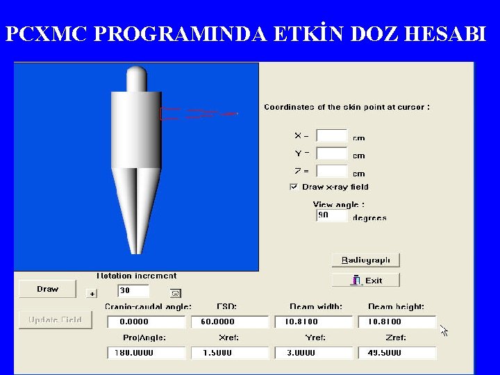 PCXMC PROGRAMINDA ETKİN DOZ HESABI 