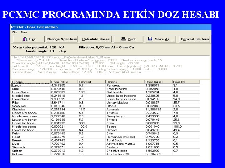 PCXMC PROGRAMINDA ETKİN DOZ HESABI 