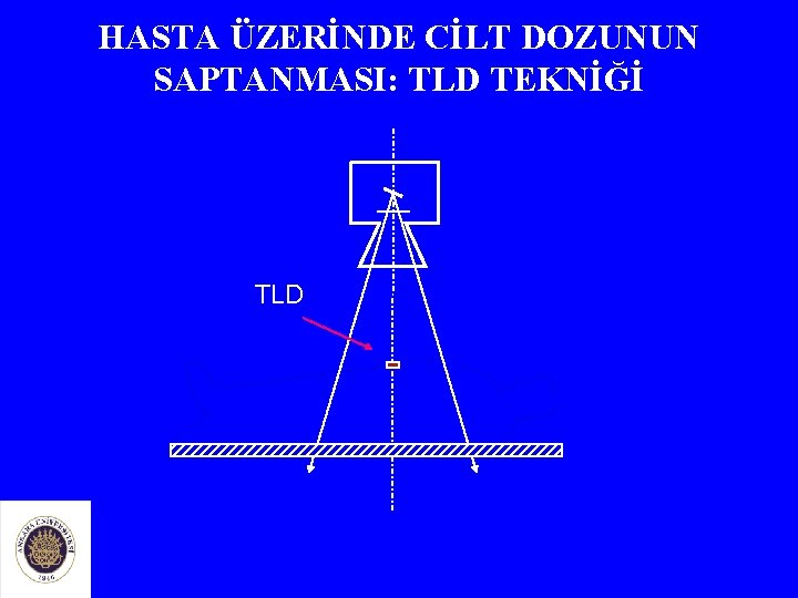 HASTA ÜZERİNDE CİLT DOZUNUN SAPTANMASI: TLD TEKNİĞİ TLD 