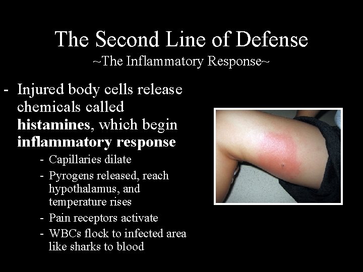 The Second Line of Defense ~The Inflammatory Response~ - Injured body cells release chemicals