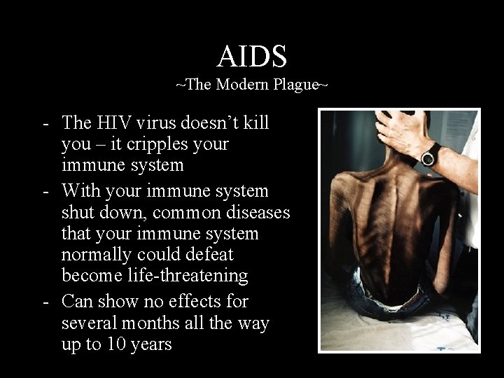 AIDS ~The Modern Plague~ - The HIV virus doesn’t kill you – it cripples