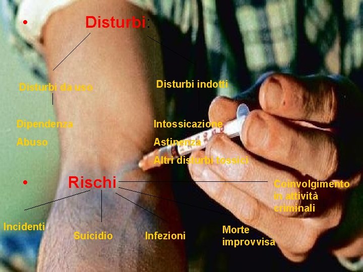• Disturbi: Disturbi da uso Disturbi indotti Dipendenza Intossicazione Abuso Astinenza Altri disturbi • Disturbi: Disturbi da uso Disturbi indotti Dipendenza Intossicazione Abuso Astinenza Altri disturbi