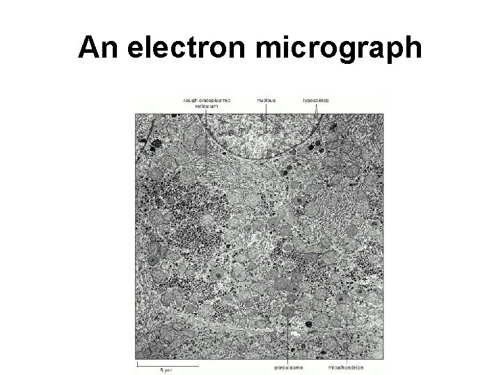 An electron micrograph 