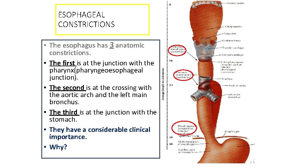 ESOPHAGEAL CONSTRICTIONS • The esophagus has 3 anatomic constrictions. • The first is at