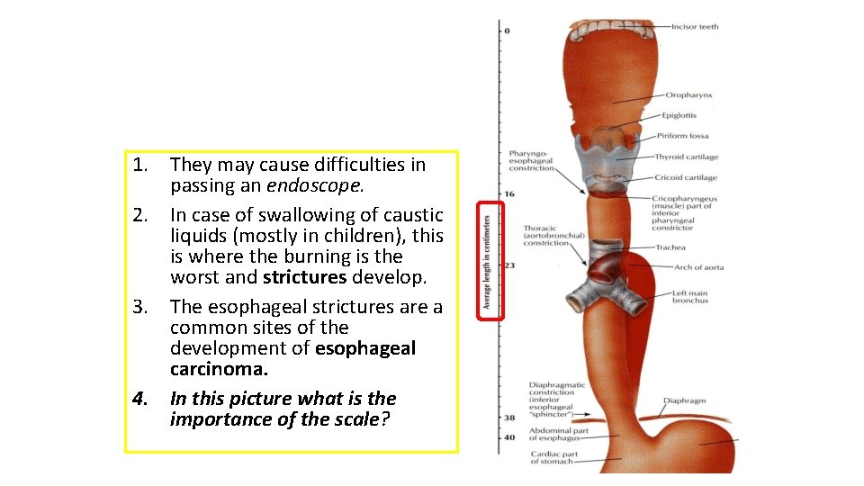 1. They may cause difficulties in passing an endoscope. 2. In case of swallowing