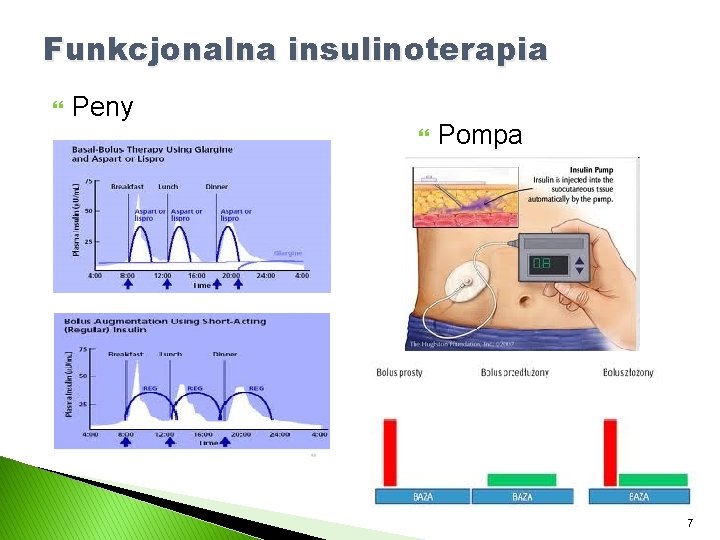 Funkcjonalna insulinoterapia Peny Pompa 7 