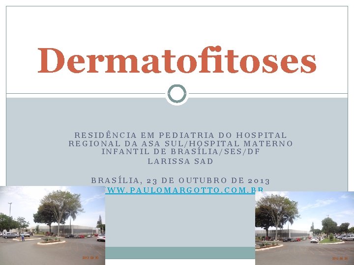 Dermatofitoses RESIDÊNCIA EM PEDIATRIA DO HOSPITAL REGIONAL DA ASA SUL/HOSPITAL MATERNO INFANTIL DE BRASÍLIA/SES/DF