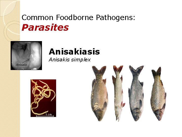 Common Foodborne Pathogens: Parasites Anisakiasis Anisakis simplex 