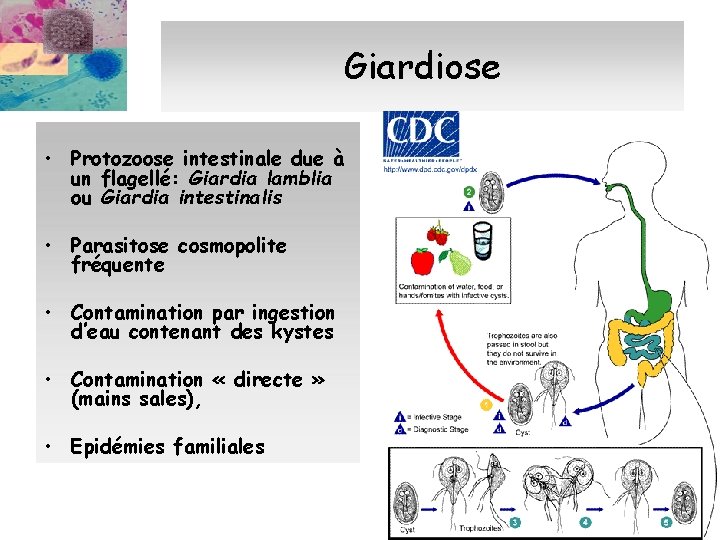 Giardiose • Protozoose intestinale due à un flagellé: Giardia lamblia ou Giardia intestinalis •