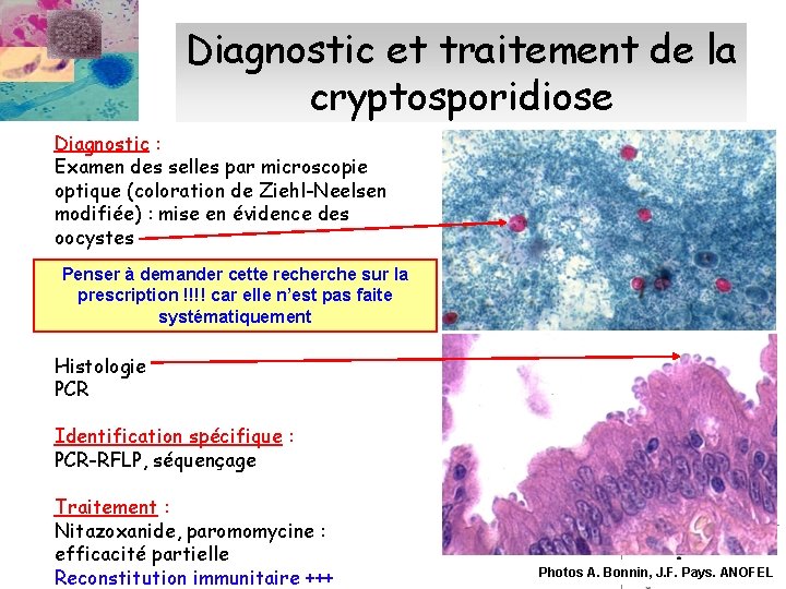 Diagnostic et traitement de la cryptosporidiose Diagnostic : Examen des selles par microscopie optique