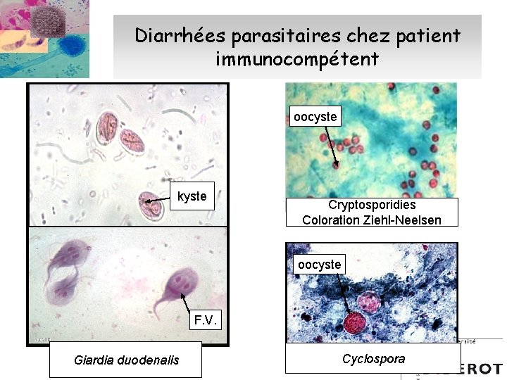 Diarrhées parasitaires chez patient immunocompétent oocyste kyste Cryptosporidies Coloration Ziehl-Neelsen oocyste oo F. V.