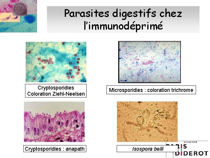 Parasites digestifs chez l’immunodéprimé Cryptosporidies Coloration Ziehl-Neelsen Cryptosporidies : anapath Microsporidies : coloration trichrome