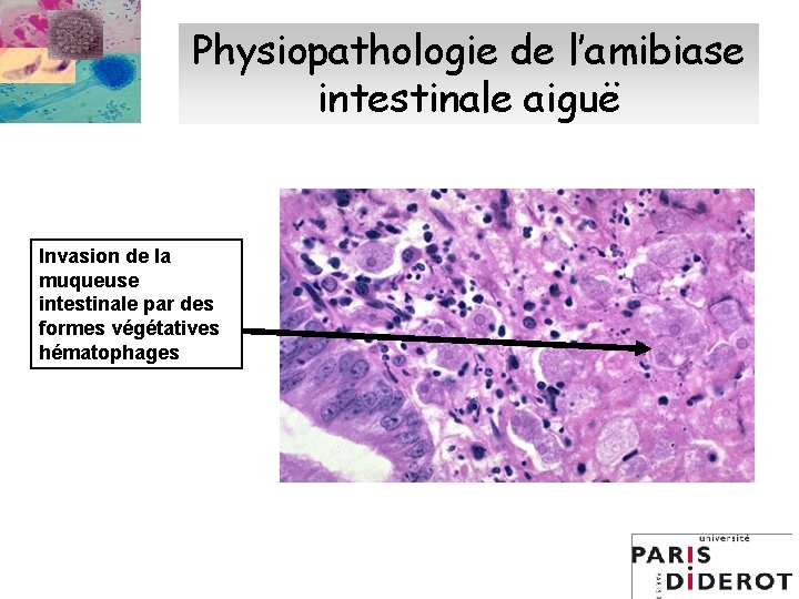 Physiopathologie de l’amibiase intestinale aiguë Invasion de la muqueuse intestinale par des formes végétatives