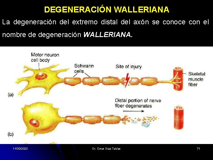 DEGENERACIÓN WALLERIANA La degeneración del extremo distal del axón se conoce con el nombre DEGENERACIÓN WALLERIANA La degeneración del extremo distal del axón se conoce con el nombre