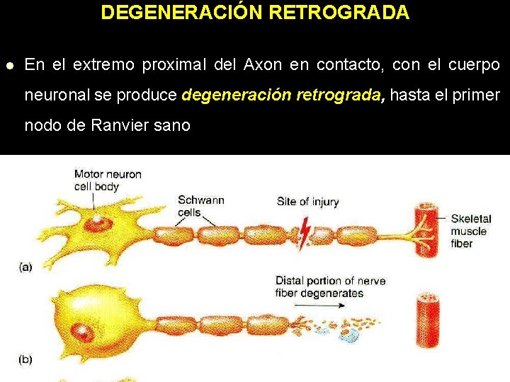 DEGENERACIÓN RETROGRADA l En el extremo proximal del Axon en contacto, con el cuerpo DEGENERACIÓN RETROGRADA l En el extremo proximal del Axon en contacto, con el cuerpo