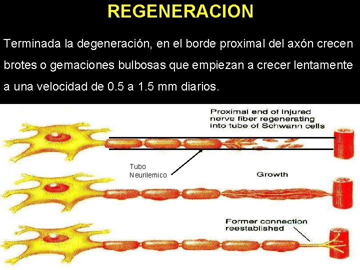 REGENERACION Terminada la degeneración, en el borde proximal del axón crecen brotes o gemaciones REGENERACION Terminada la degeneración, en el borde proximal del axón crecen brotes o gemaciones