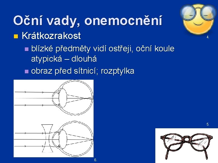 Oční vady, onemocnění n Krátkozrakost 4. blízké předměty vidí ostřeji, oční koule atypická –