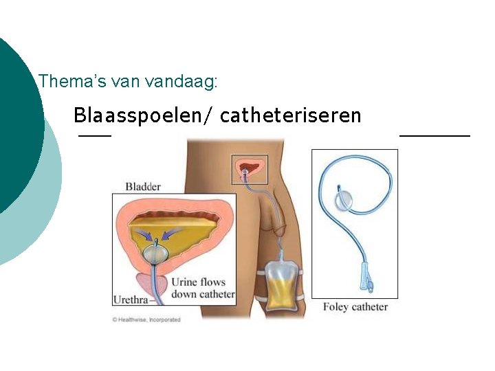 Thema’s vandaag: Blaasspoelen/ catheteriseren 