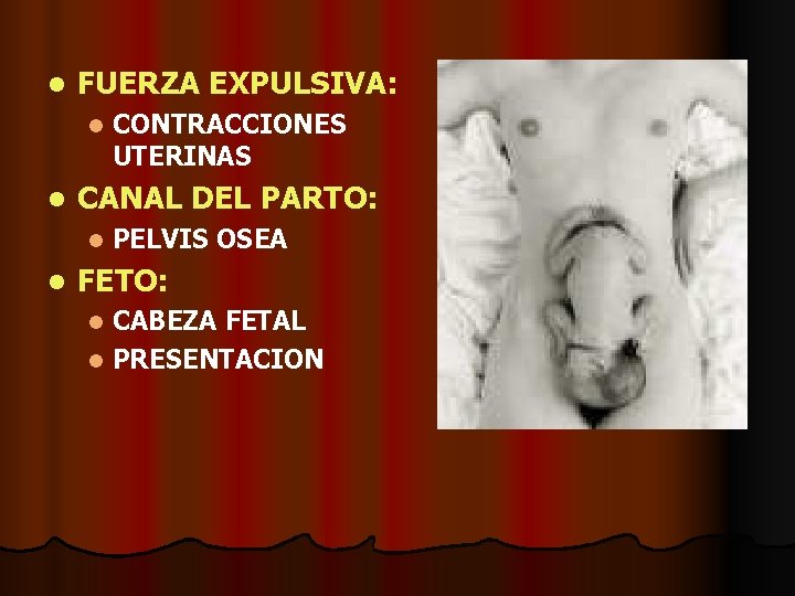 l FUERZA EXPULSIVA: l l CANAL DEL PARTO: l l CONTRACCIONES UTERINAS PELVIS OSEA