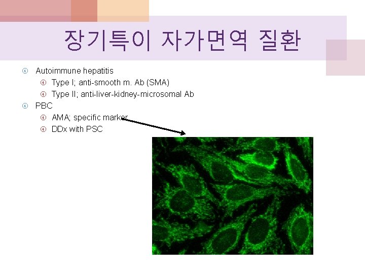 장기특이 자가면역 질환 Autoimmune hepatitis Type I; anti-smooth m. Ab (SMA) Type II; anti-liver-kidney-microsomal