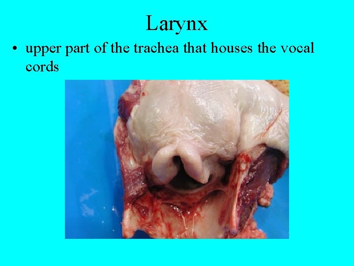Larynx • upper part of the trachea that houses the vocal cords 