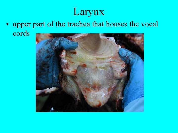 Larynx • upper part of the trachea that houses the vocal cords 