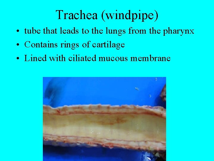 Trachea (windpipe) • tube that leads to the lungs from the pharynx • Contains