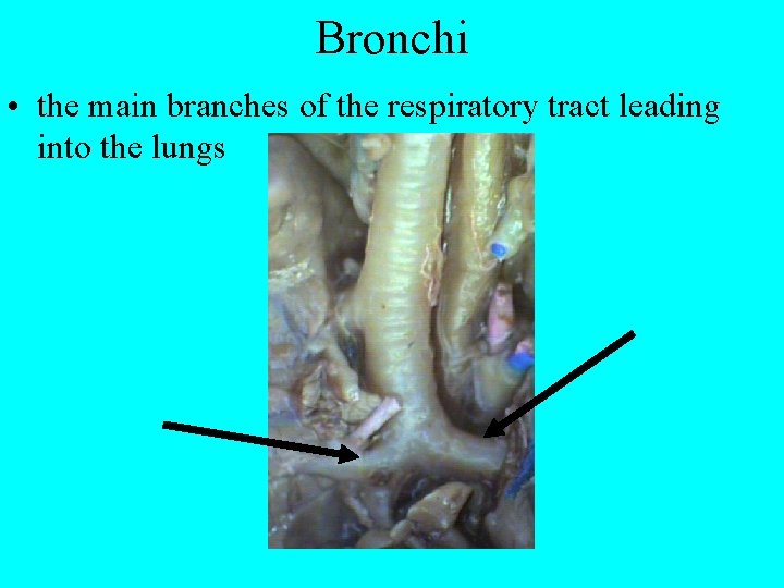 Bronchi • the main branches of the respiratory tract leading into the lungs 