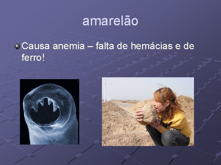 amarelão Causa anemia – falta de hemácias e de ferro! 