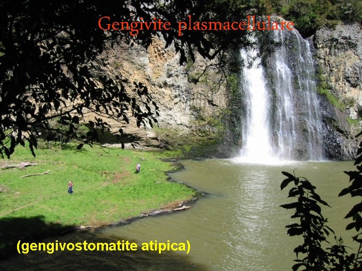 Gengivite plasmacellulare (gengivostomatite atipica) 