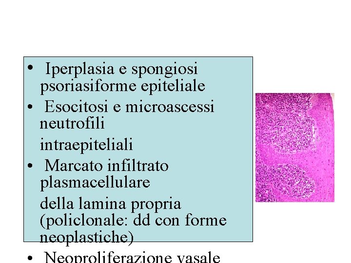  • Iperplasia e spongiosi psoriasiforme epiteliale • Esocitosi e microascessi neutrofili intraepiteliali •