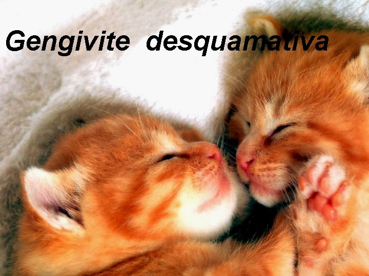 Gengivite desquamativa 