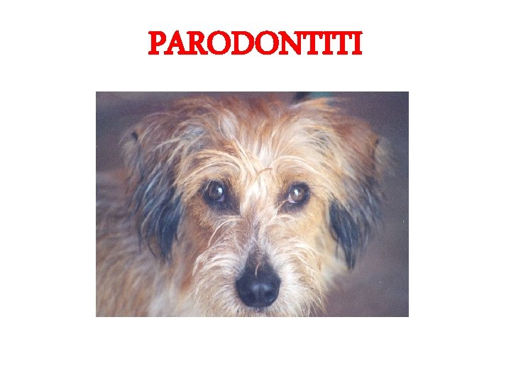 PARODONTITI 