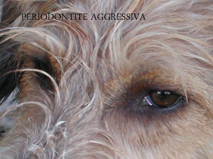 PERIODONTITE AGGRESSIVA 
