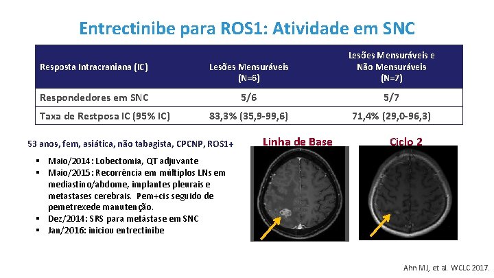 Entrectinibe para ROS 1: Atividade em SNC Resposta Intracraniana (IC) Lesões Mensuráveis (N=6) Lesões