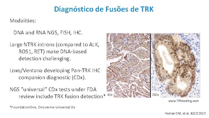 Diagnóstico de Fusões de TRK Modalities: DNA and RNA NGS, FISH, IHC. Large NTRK