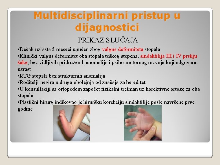 Multidisciplinarni pristup u dijagnostici PRIKAZ SLUČAJA • Dečak uzrasta 5 meseci upućen zbog valgus