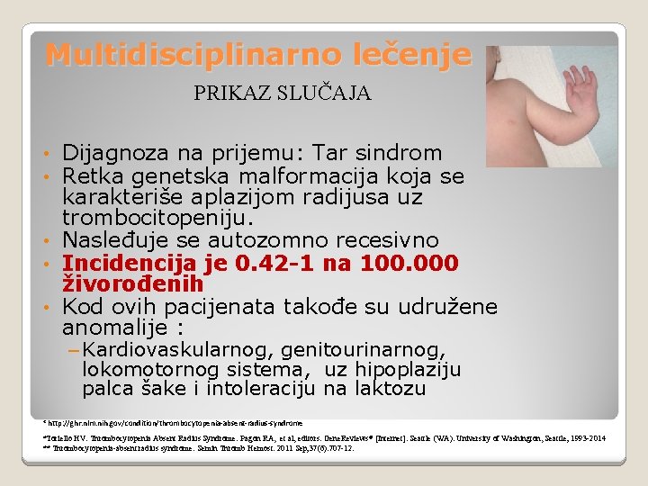 Multidisciplinarno lečenje PRIKAZ SLUČAJA Dijagnoza na prijemu: Tar sindrom Retka genetska malformacija koja se