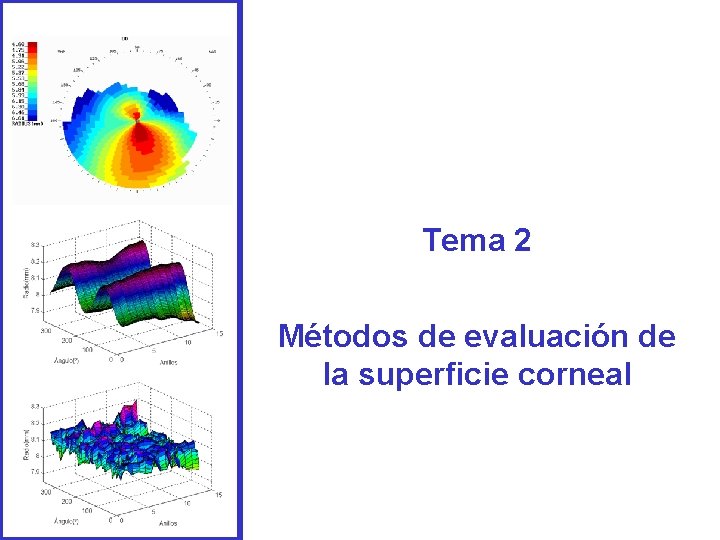 Tema 2 Métodos de evaluación de la superficie corneal Tema 2 Métodos de evaluación de la superficie corneal