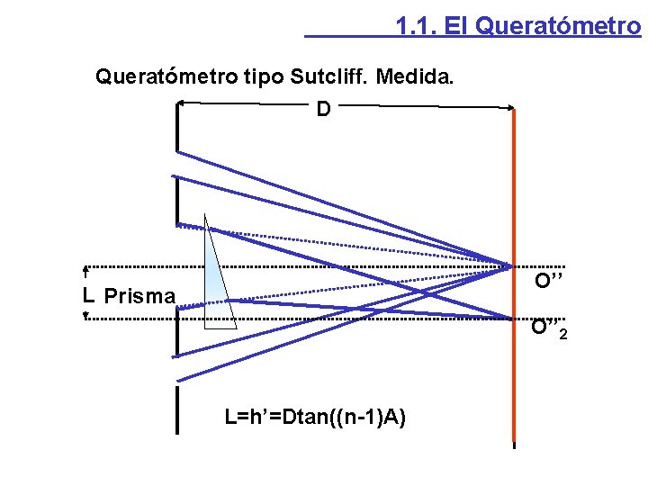 1. 1. El Queratómetro tipo Sutcliff. Medida. D O’’ L Prisma O’’ 2 L=h’=Dtan((n-1)A) 1. 1. El Queratómetro tipo Sutcliff. Medida. D O’’ L Prisma O’’ 2 L=h’=Dtan((n-1)A)