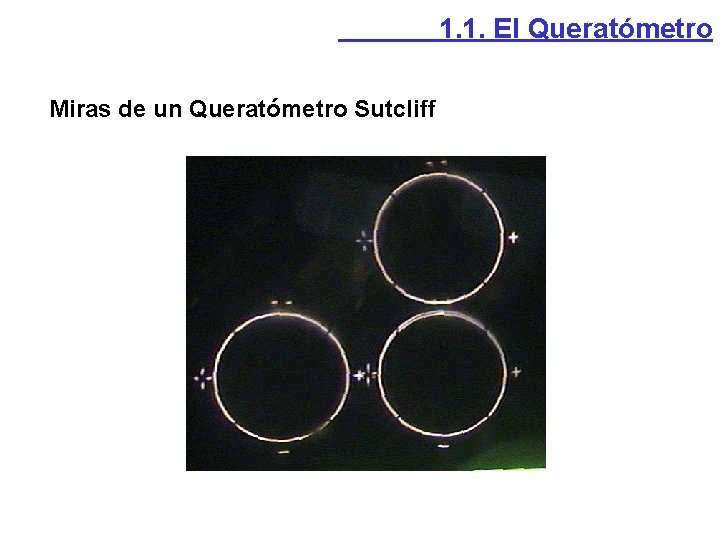 1. 1. El Queratómetro Miras de un Queratómetro Sutcliff 1. 1. El Queratómetro Miras de un Queratómetro Sutcliff