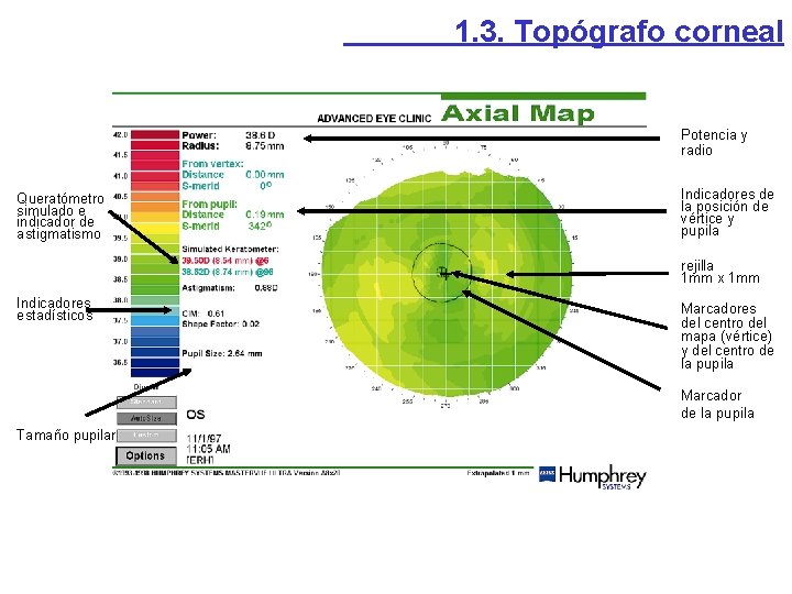 1. 3. Topógrafo corneal Potencia y radio Queratómetro simulado e indicador de astigmatismo Indicadores 1. 3. Topógrafo corneal Potencia y radio Queratómetro simulado e indicador de astigmatismo Indicadores