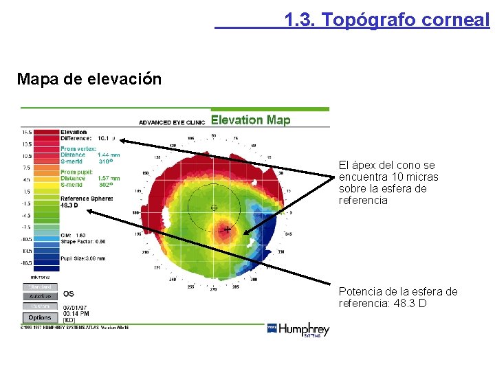 1. 3. Topógrafo corneal Mapa de elevación El ápex del cono se encuentra 10 1. 3. Topógrafo corneal Mapa de elevación El ápex del cono se encuentra 10