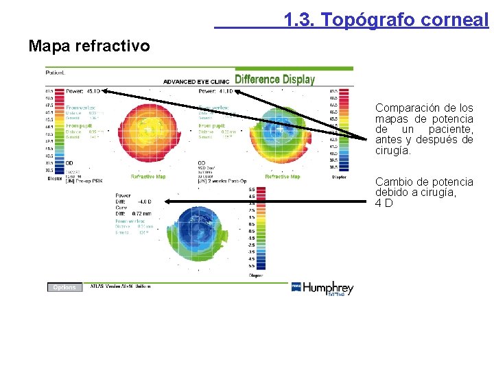 1. 3. Topógrafo corneal Mapa refractivo Comparación de los mapas de potencia de un 1. 3. Topógrafo corneal Mapa refractivo Comparación de los mapas de potencia de un