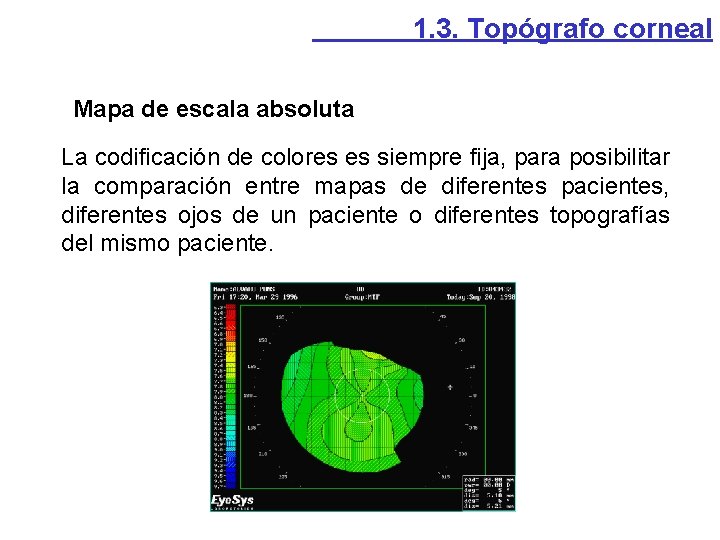 1. 3. Topógrafo corneal Mapa de escala absoluta La codificación de colores es siempre 1. 3. Topógrafo corneal Mapa de escala absoluta La codificación de colores es siempre