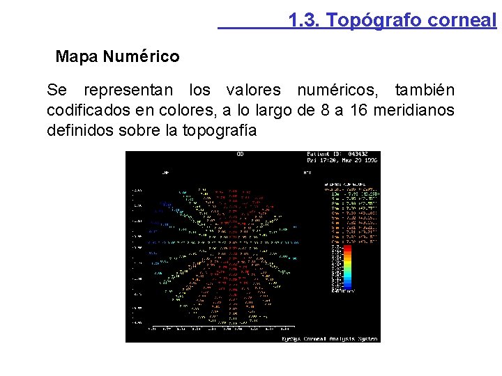 1. 3. Topógrafo corneal Mapa Numérico Se representan los valores numéricos, también codificados en 1. 3. Topógrafo corneal Mapa Numérico Se representan los valores numéricos, también codificados en