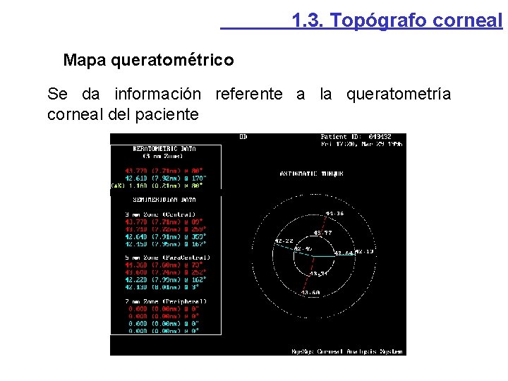 1. 3. Topógrafo corneal Mapa queratométrico Se da información referente a la queratometría corneal 1. 3. Topógrafo corneal Mapa queratométrico Se da información referente a la queratometría corneal