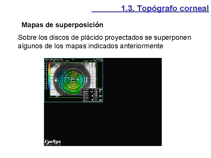 1. 3. Topógrafo corneal Mapas de superposición Sobre los discos de plácido proyectados se 1. 3. Topógrafo corneal Mapas de superposición Sobre los discos de plácido proyectados se