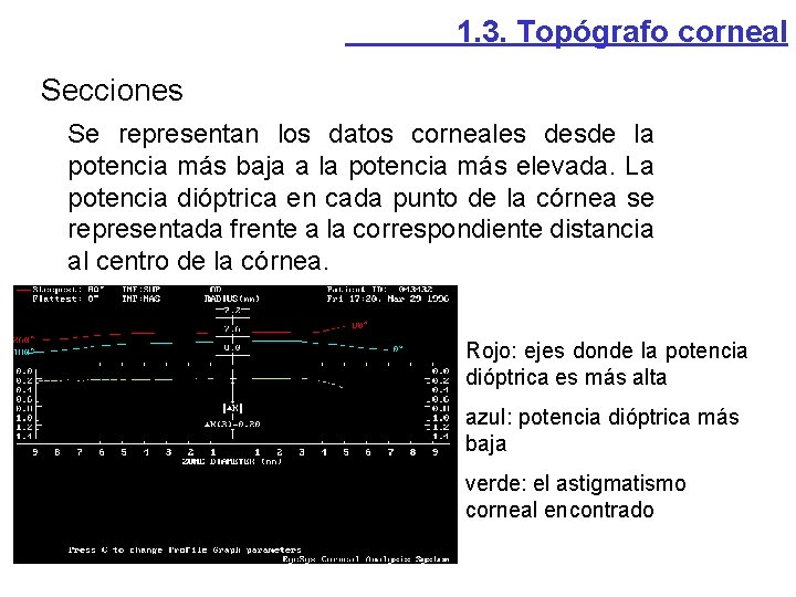 1. 3. Topógrafo corneal Secciones Se representan los datos corneales desde la potencia más 1. 3. Topógrafo corneal Secciones Se representan los datos corneales desde la potencia más